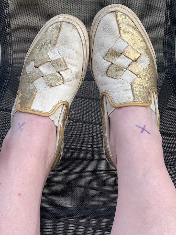 Plague Diary, March 9,&nbsp;2021